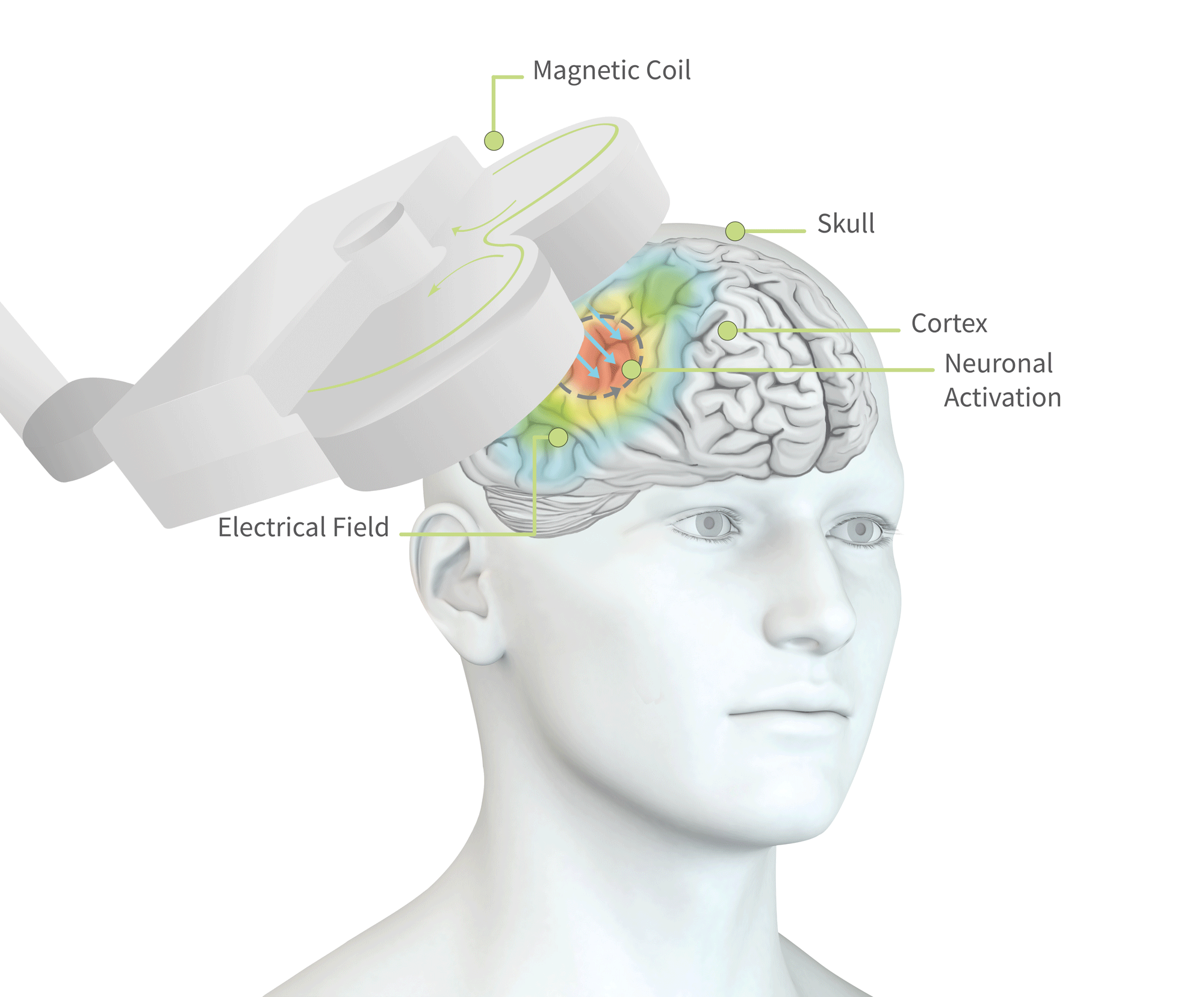 tms treatment for adhd